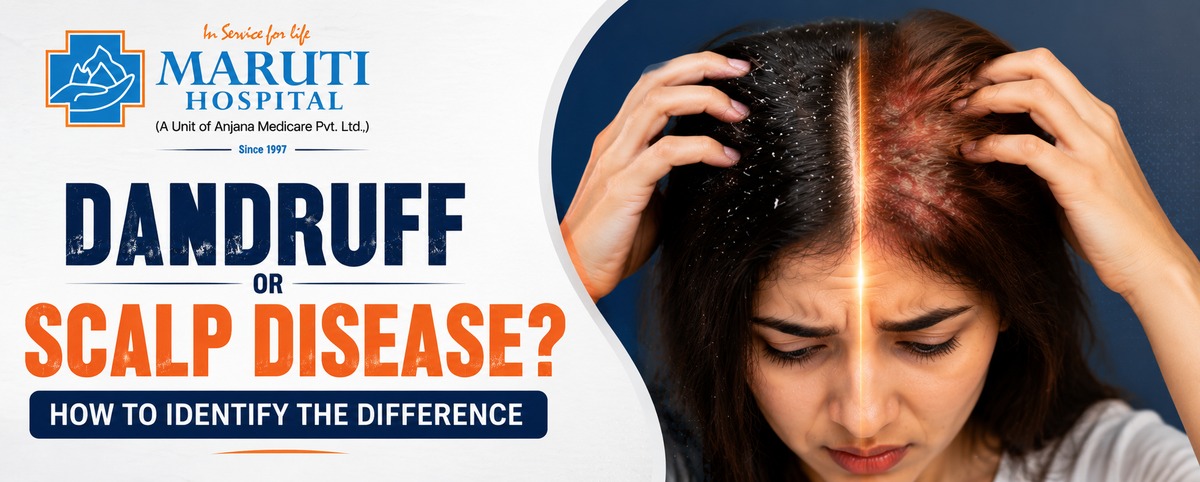 Dandruff or Scalp Disease? How to Identify the Difference